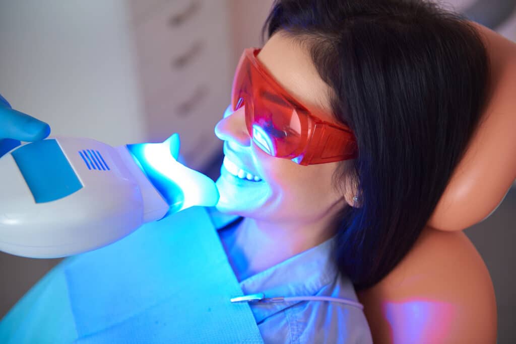 How Often Should You Wait Between Teeth Whitening