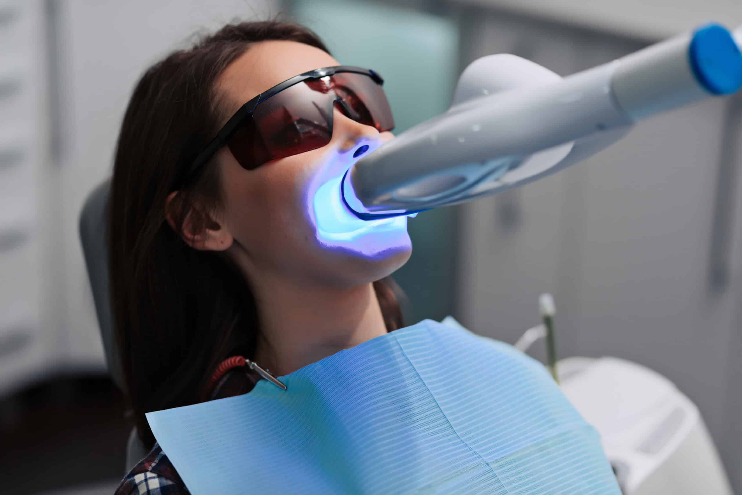 Is Laser Teeth Whitening Safe? Everything You Need to Know